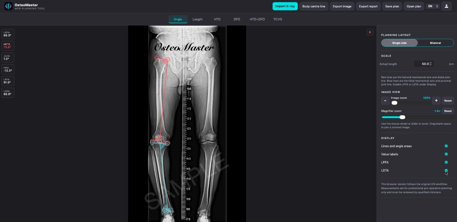 OsteoMaster desktop browser angle measurement workspace